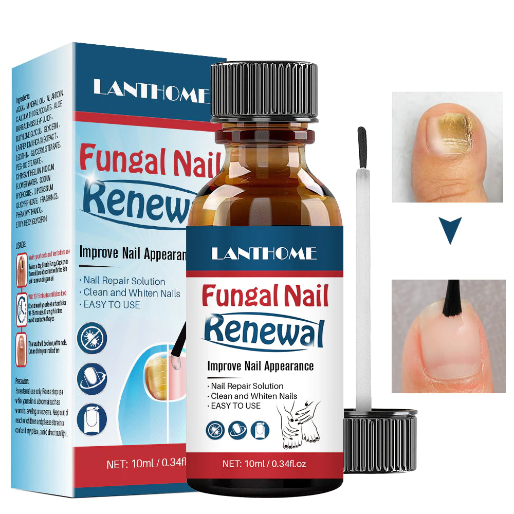 Fungal Nail Renewal Solution