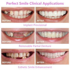 Invisible orthodontic braces and teeth care products